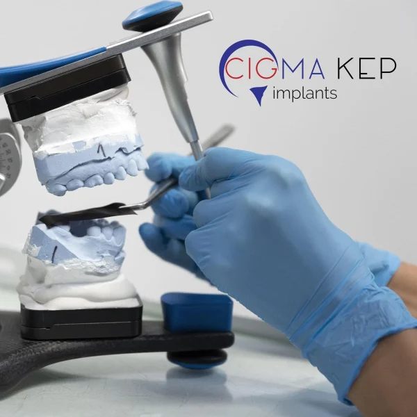 Cigma Kep